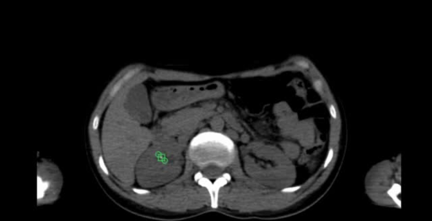 CT scanner in a hospital imaging room