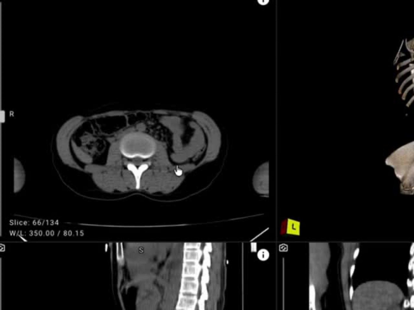 Clinicians reviewing imaging together