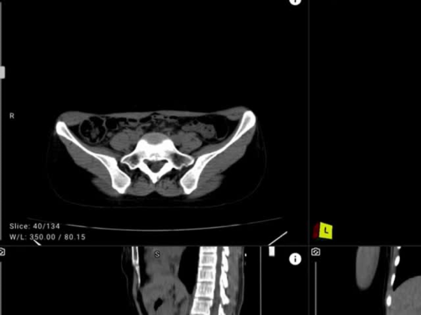 High-resolution medical imaging detail