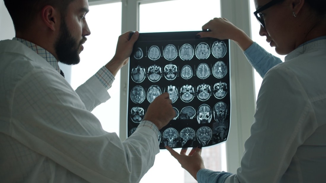 Doctors reviewing brain MRI scans together